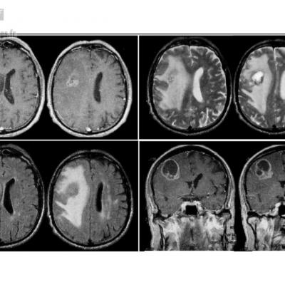 Planche d'images du cerveau obtenues par IRM 