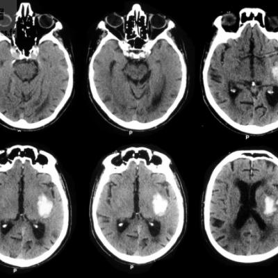 Planche d'images du cerveau obtenues grâce au scanner